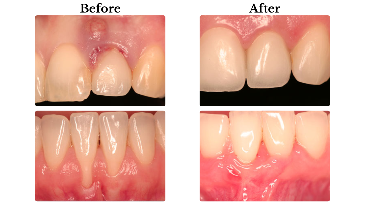 teeth-dr-caplanis